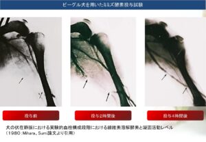 伏在静脈の血栓溶解作用